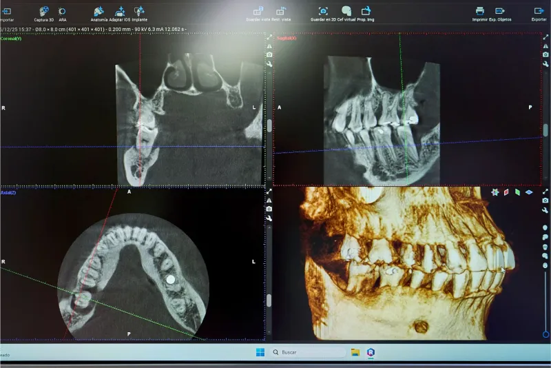 Software Escáner 3D